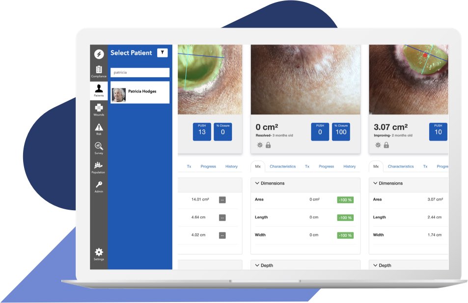 Swift Virtual Wound Module Swift