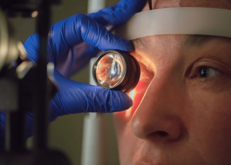 Cataracts Basics Switch Eye Center