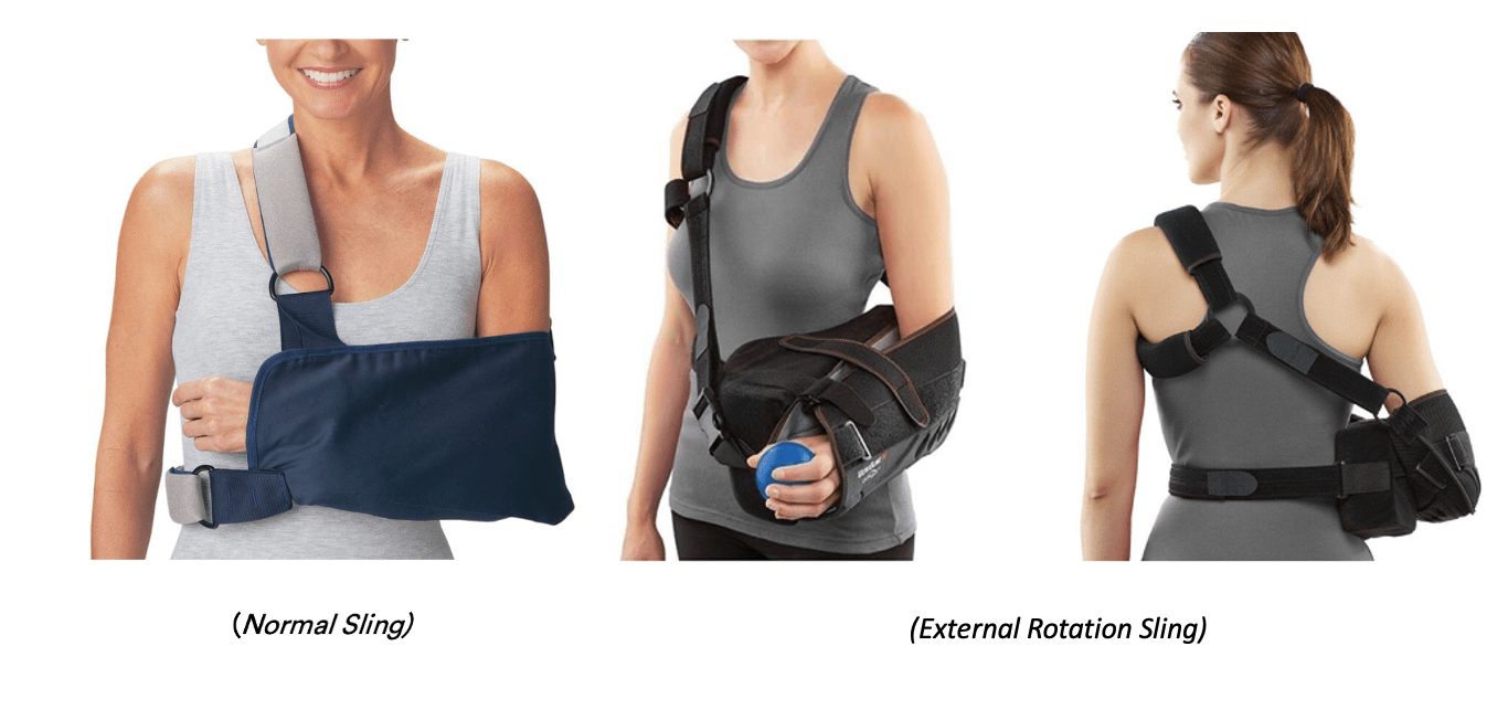 Shoulder Dislocations Dr Pant Sydney Shoulder Unit