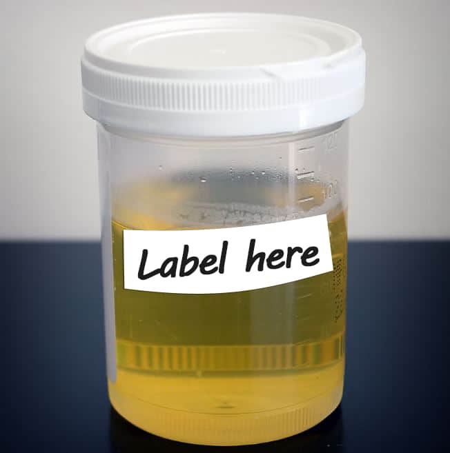 How to Preserve Human Urine 9 Simple Tips For Storing It