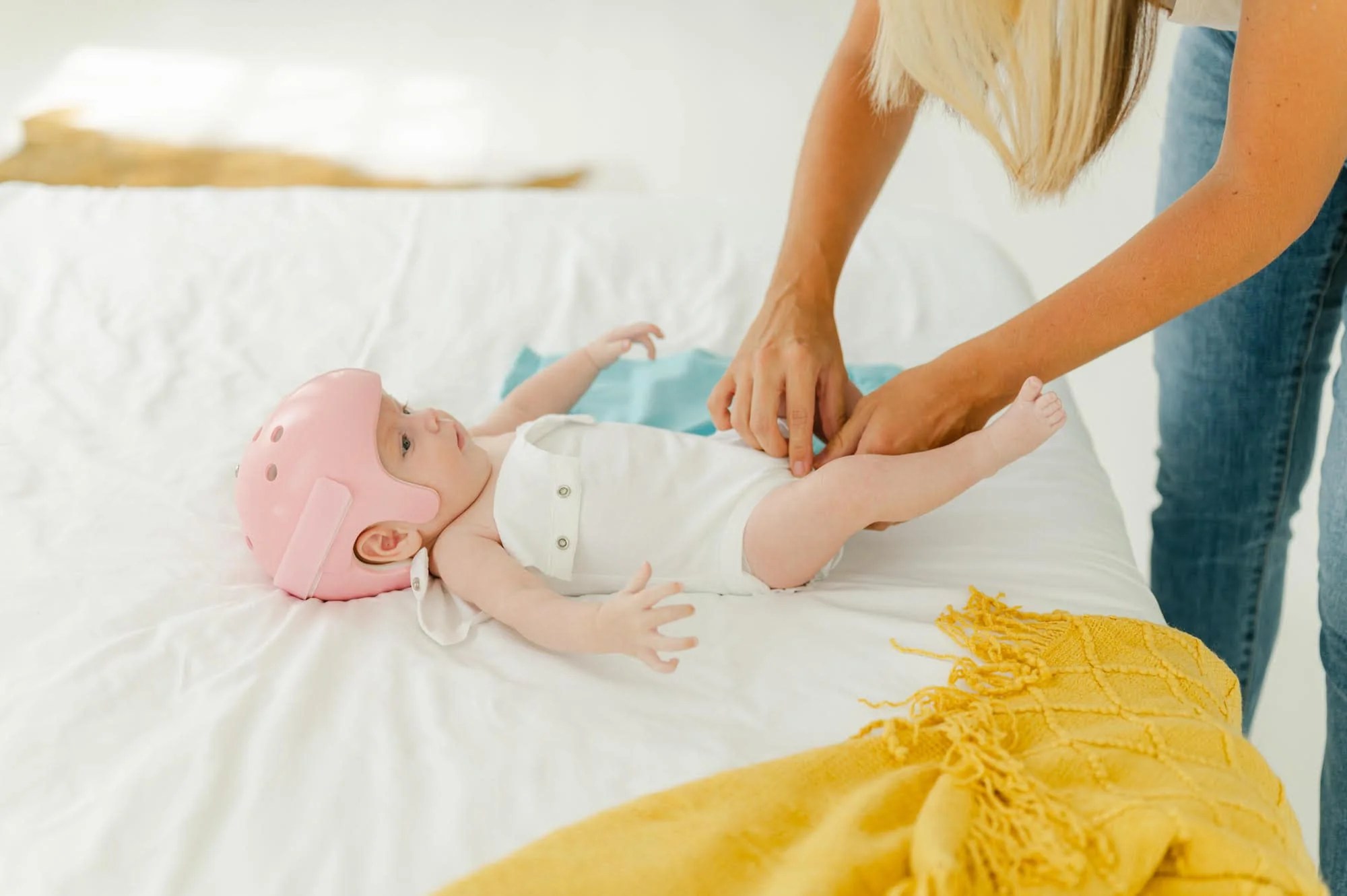 Why Do Babies Wear Helmets? Tabeeze