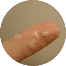 Regenboog Van Vaginale Afscheiding - Taboeloos