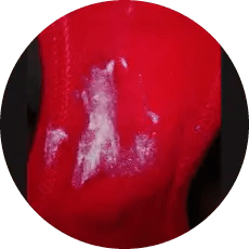 Regenboog Van Vaginale Afscheiding - Taboeloos