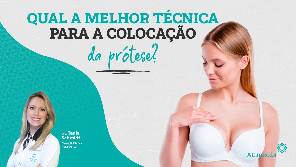 Qual a melhor técnica para a colocação da prótese? TAC