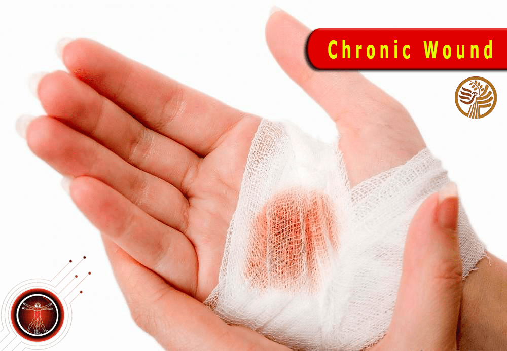 Vitamin D3 Case Study 4 3Year Dangerous Chronic Wound Completely