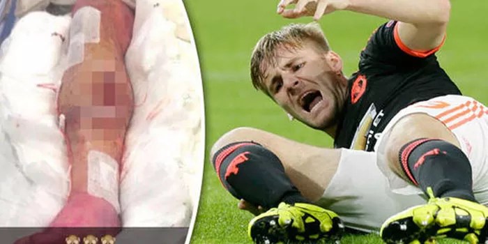 Luke Shaw Terpuruk: Saya Sangat Hancur oleh Cedera ku Lagi!