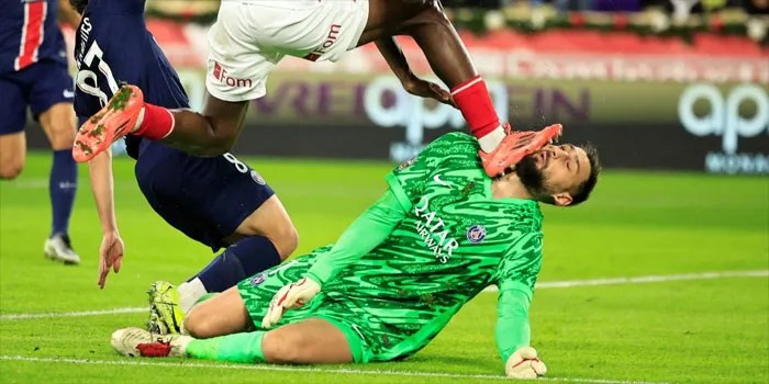 Cedera Wajah Donnarumma yang Fatal