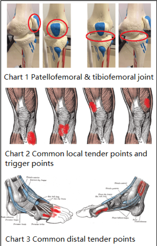 Knee Pain Talented Hands Physical Therapy & Acupuncture