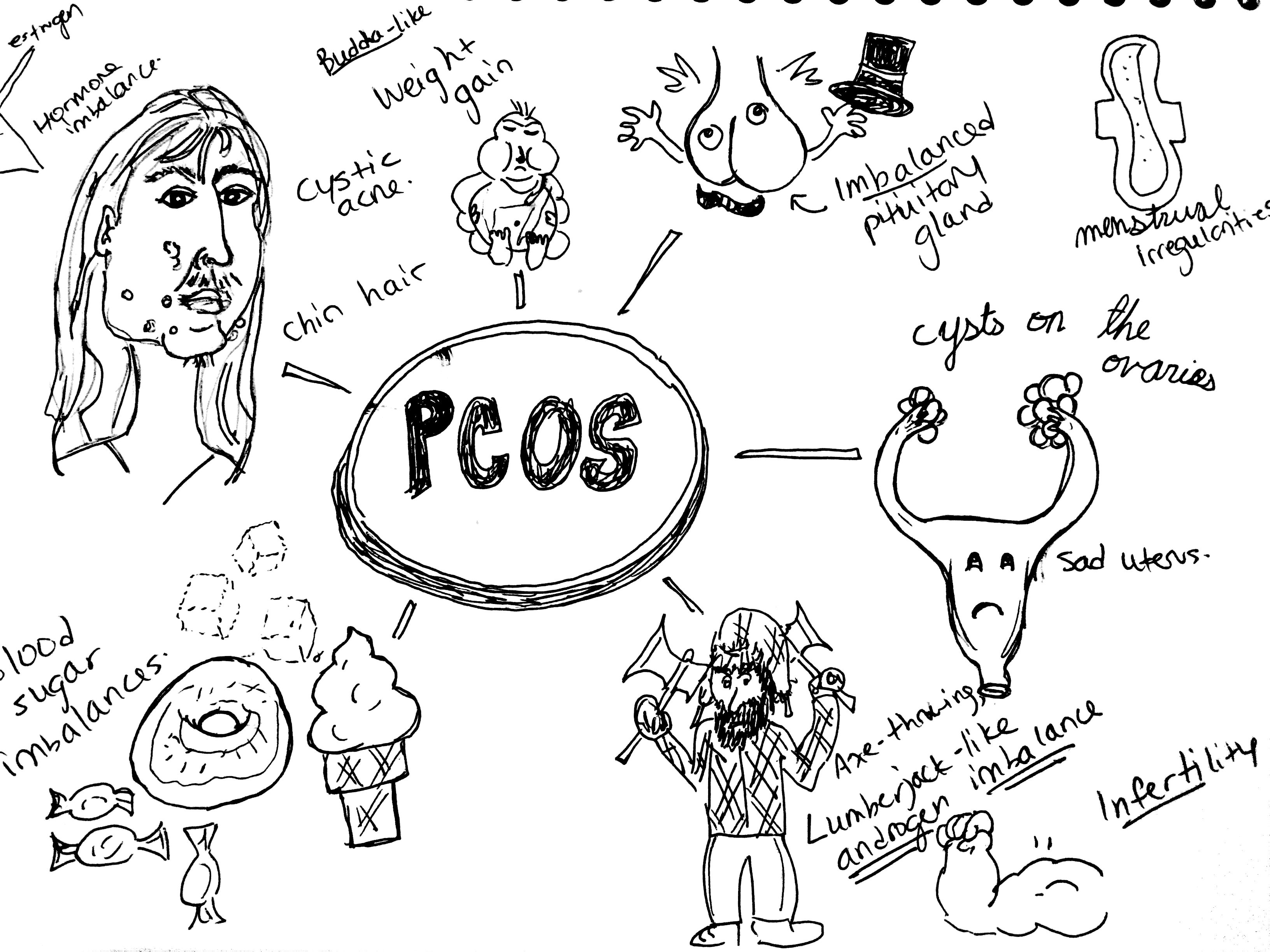 Polycystic Ovarian Syndrome The Good, the Bad and the Hairy Dr