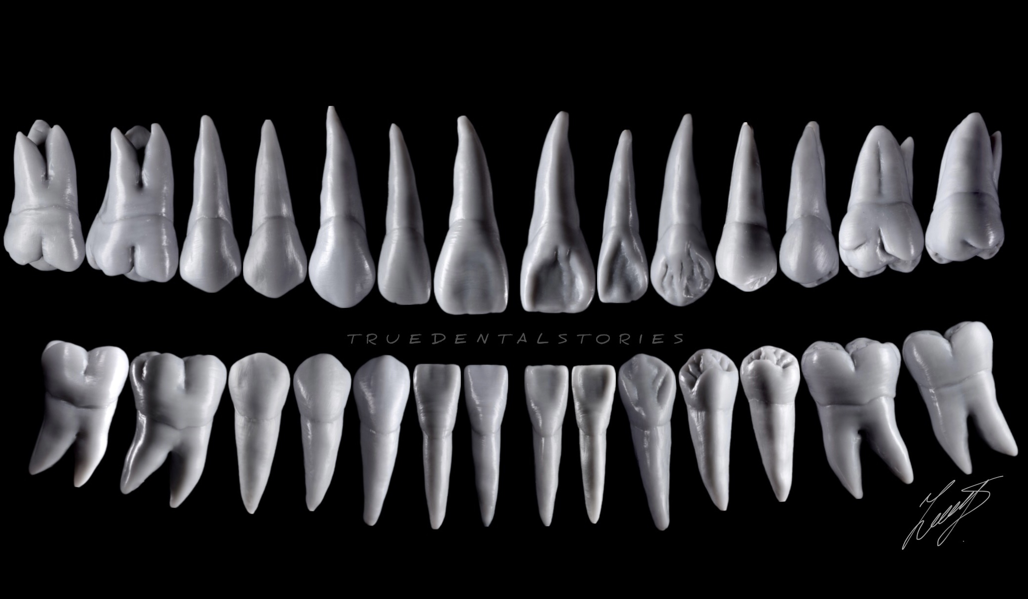 What dental prostheses types should you consider