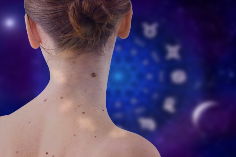 Mole Astrology Meaning of Moles on Different Parts of the Body
