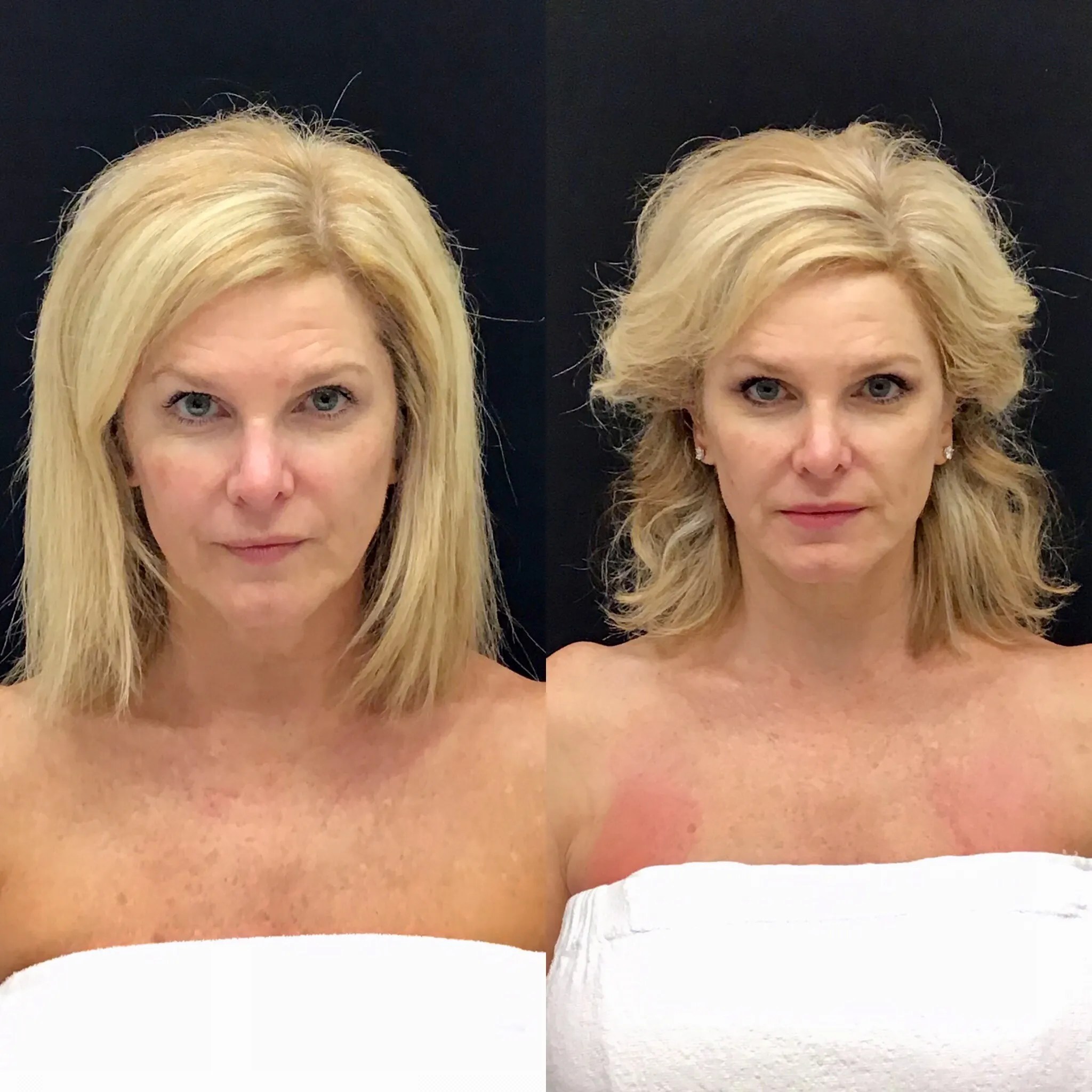 forma facial near me