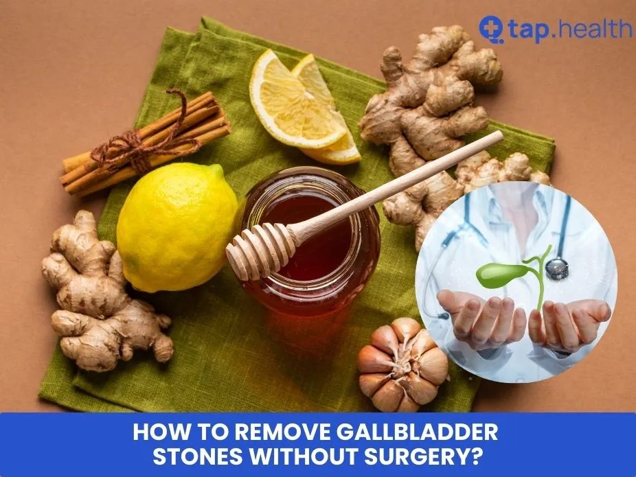 How To Remove Gallbladder Stones Without Surgery/Operation? Tap Health