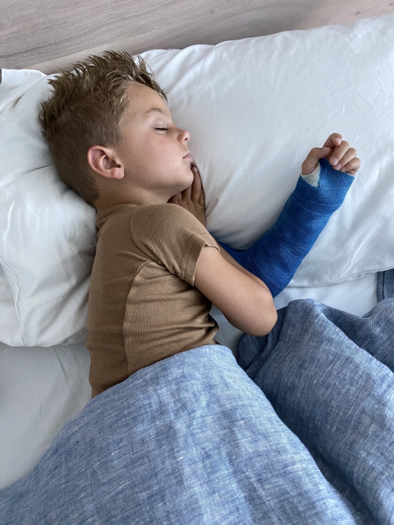 Surviving Summer & Swimming With A Broken Arm Tara Thueson