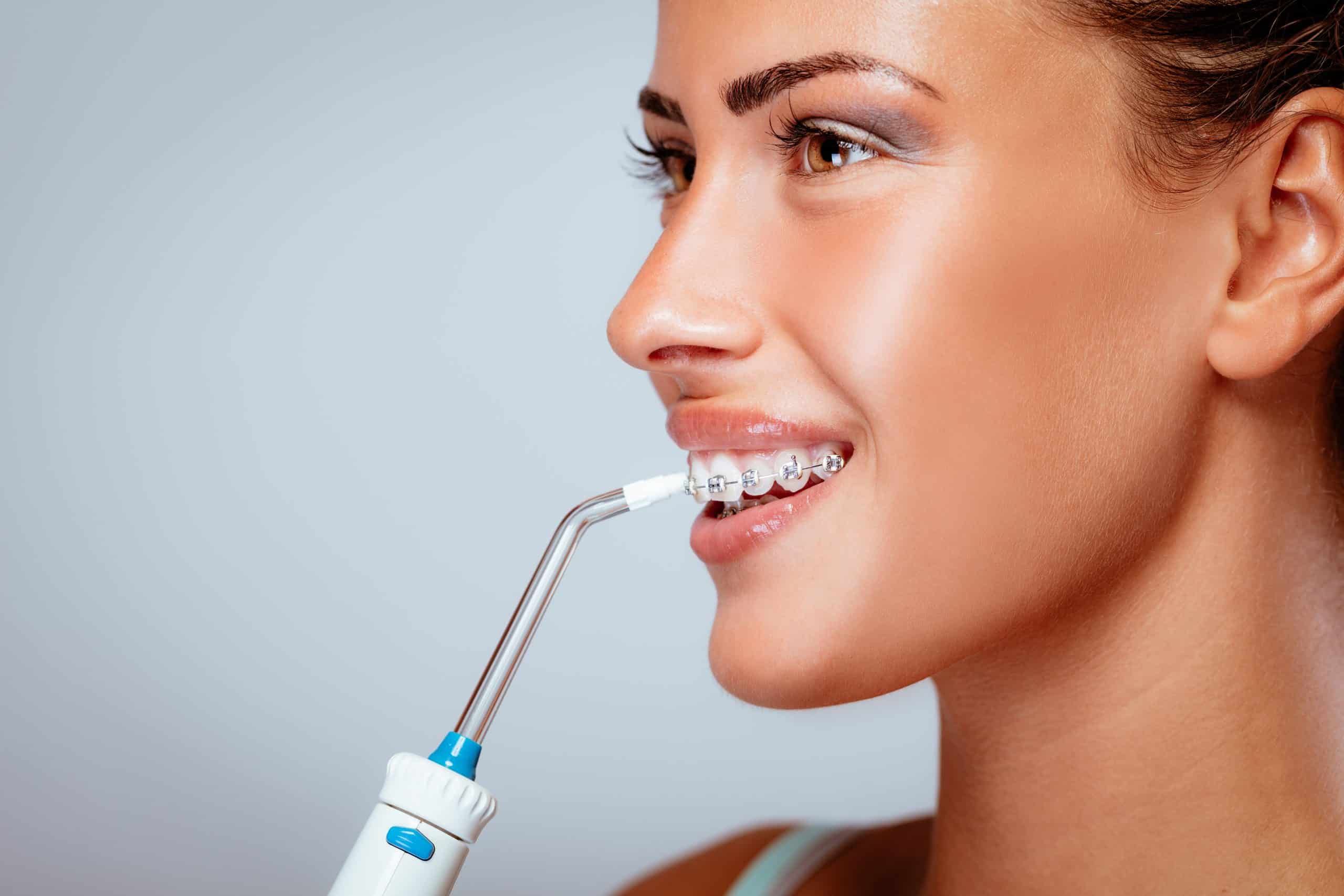 Guide to Flossing with Braces Methods, Tips, and More for Optimal Oral