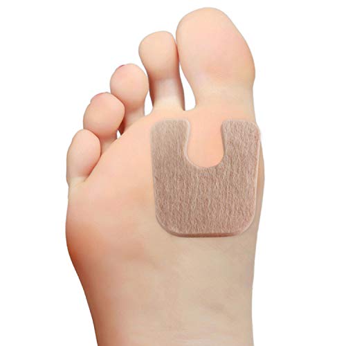 Best Shoes For Callus On Ball Of Foot (2023 Updated) Taste of St. Louis