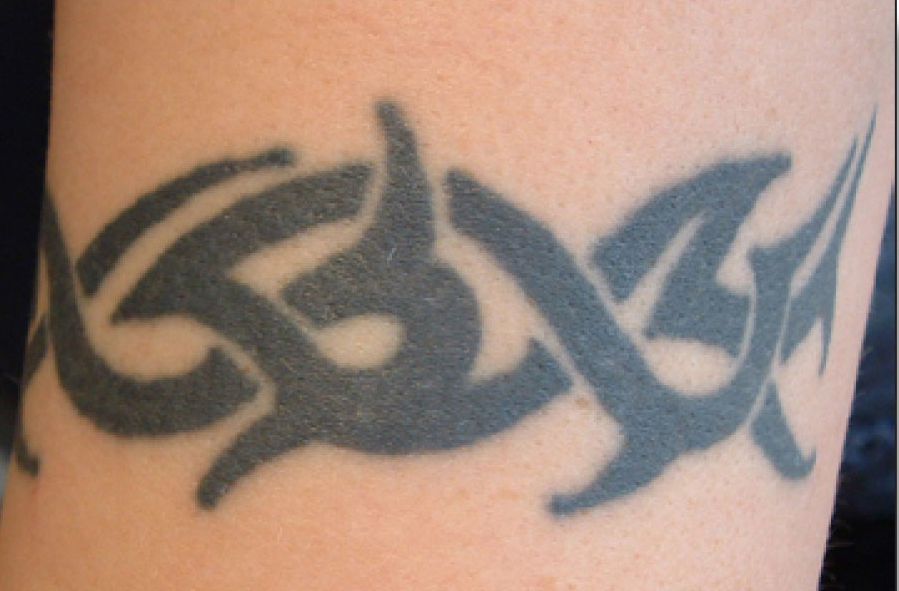 How Much Do Tattoos Cost? Calculator Tatt2Away®