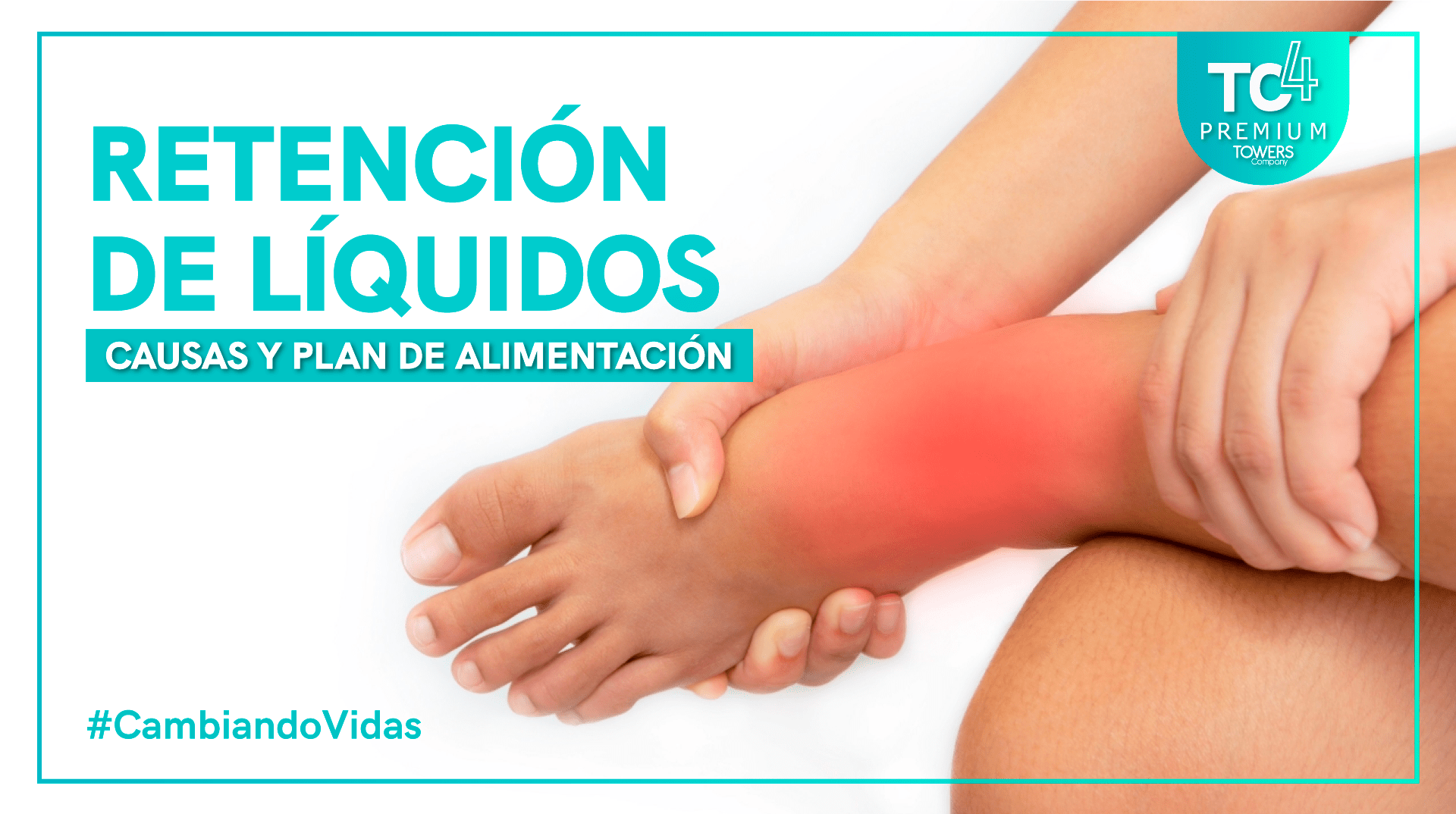 Retención de líquidos causas y plan de alimentación TC4