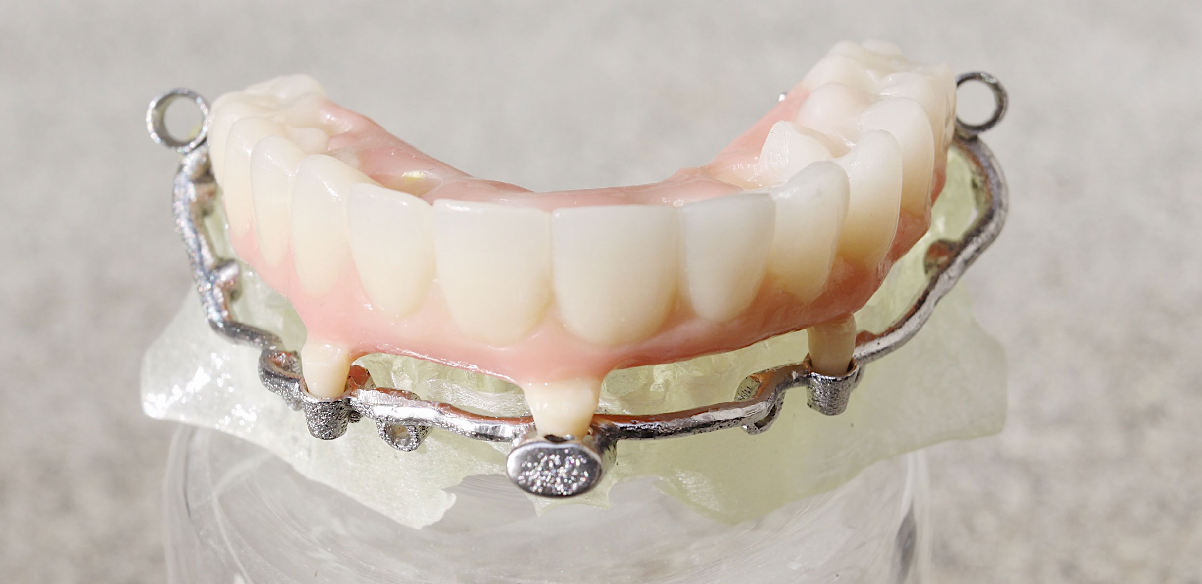 Stackable Guides TC Dental Lab