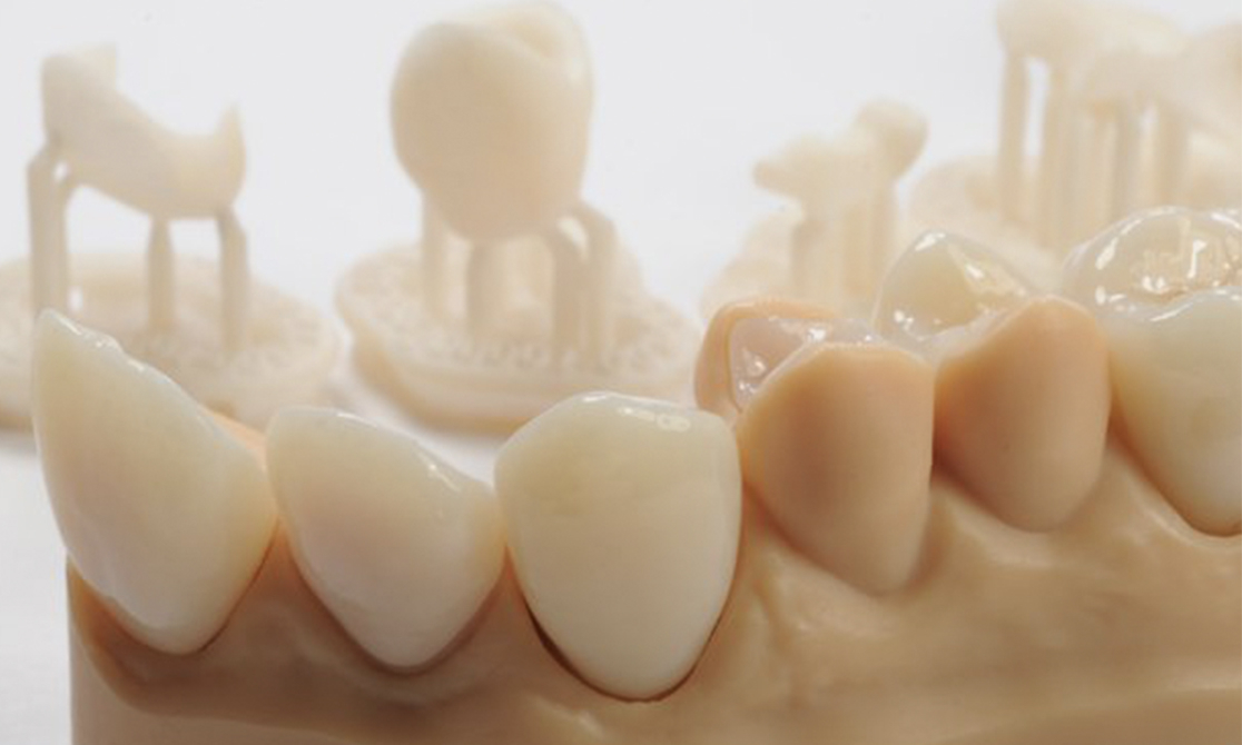 How to 3D Print Dental Crowns & Bridge Models