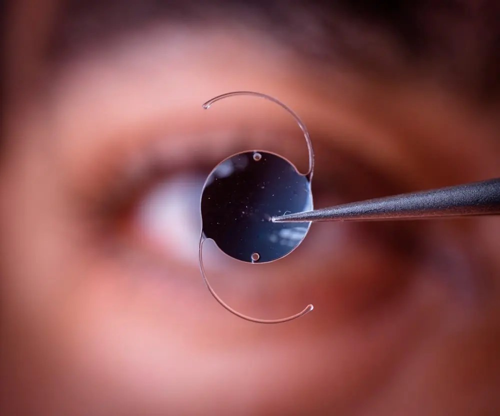 Clear Lens Exchange (CLE) Twin Cities Eye Consultants