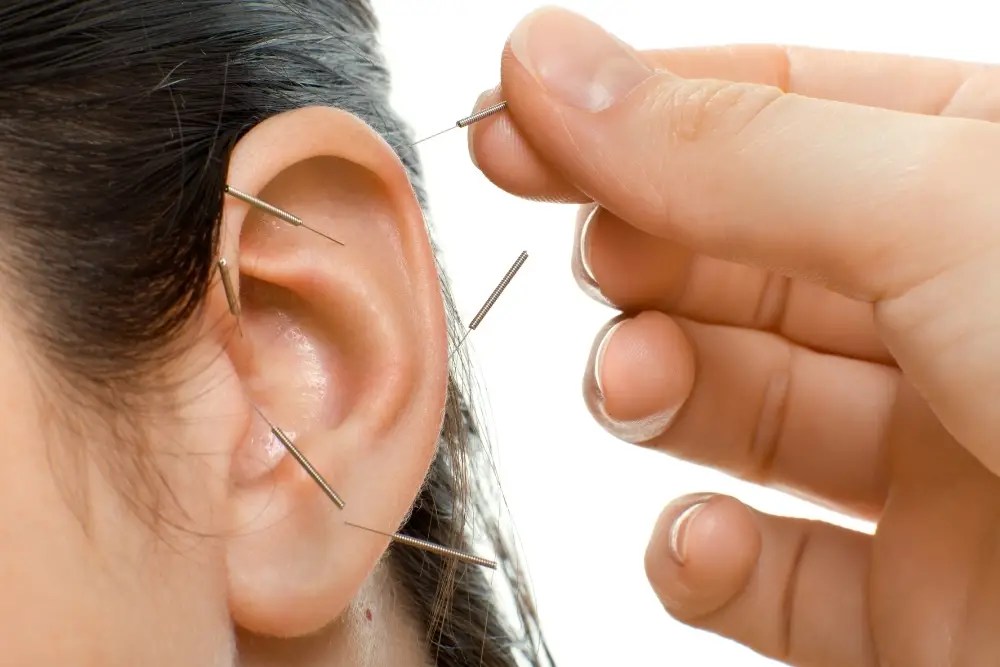 Acupuncture Ear Seeds Points Easy TCM Wisdom Your Path to DIY
