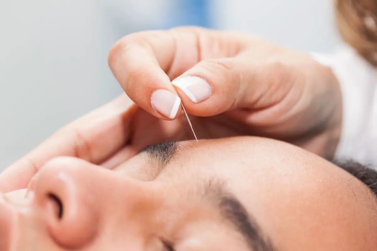 How To Use Acupuncture Pen On Face Easy TCM Wisdom Your Path to DIY Health and Wellness