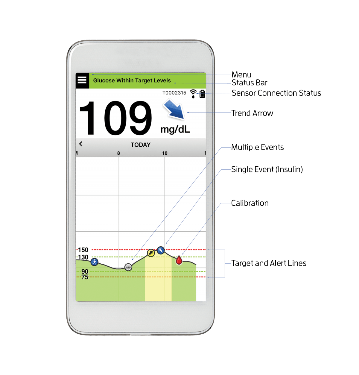 My LifeChanging Trial of the Eversense CGM Taking Control Of Your