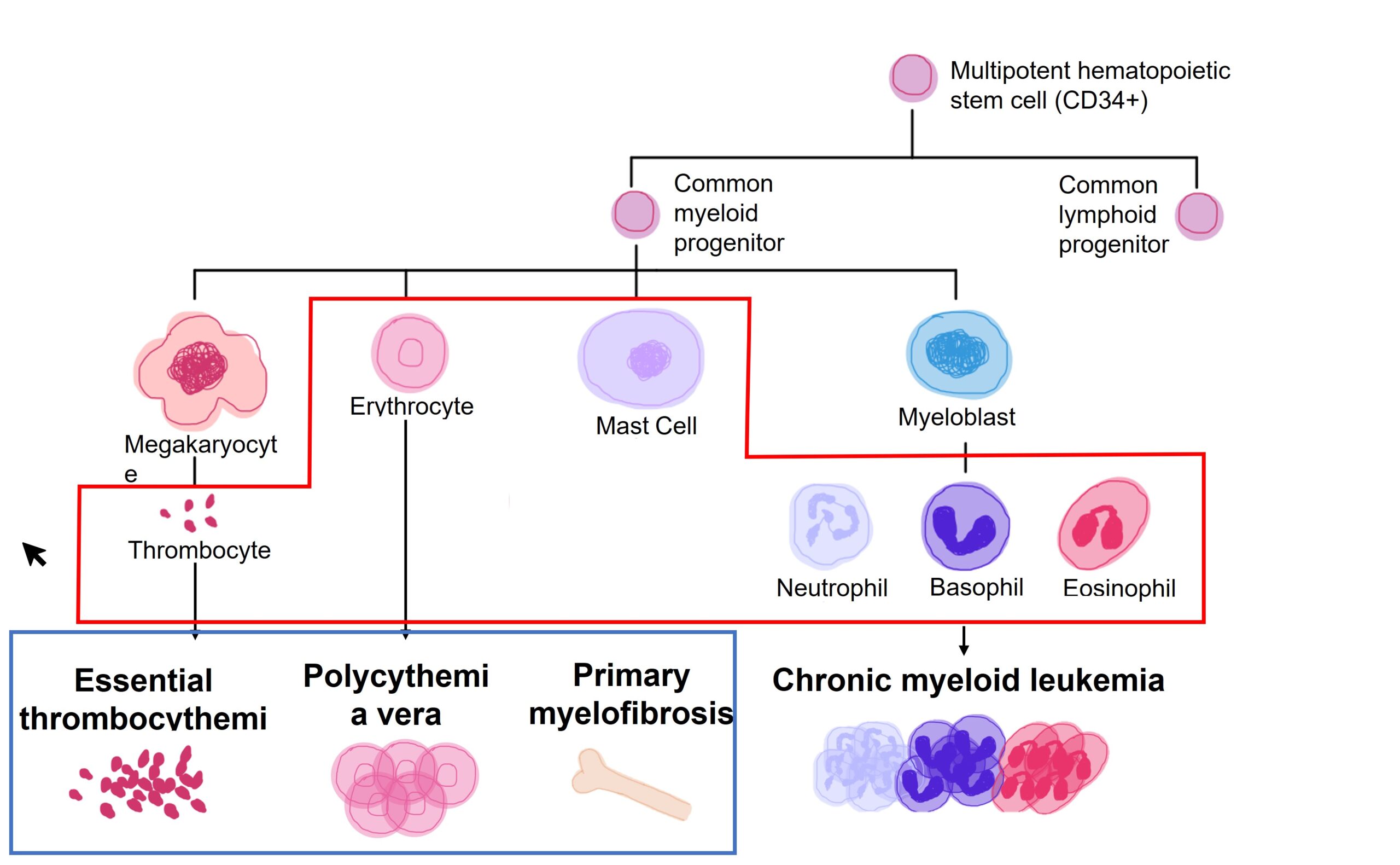 Myeloproliferative Neoplasms teachIM