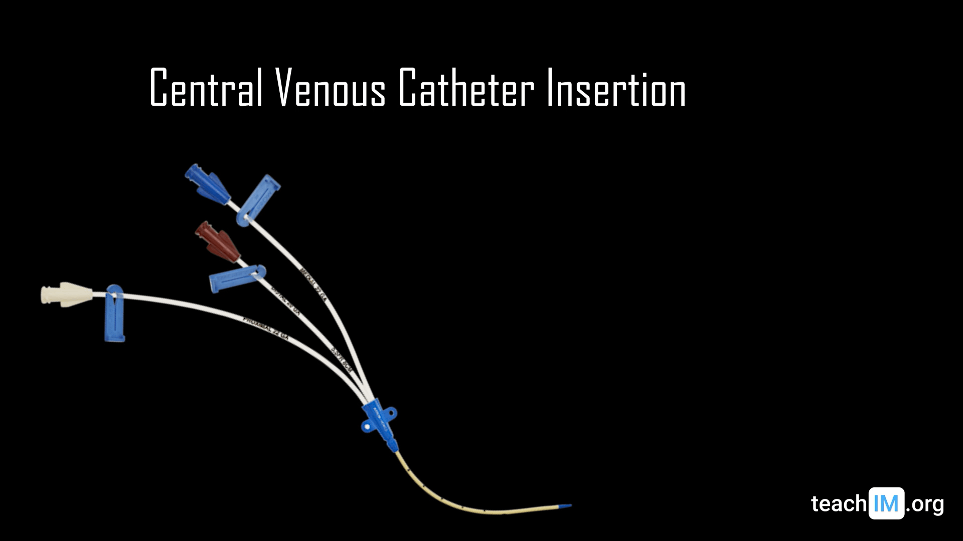 Triple Lumen Catheter Proximal Medial And Distal