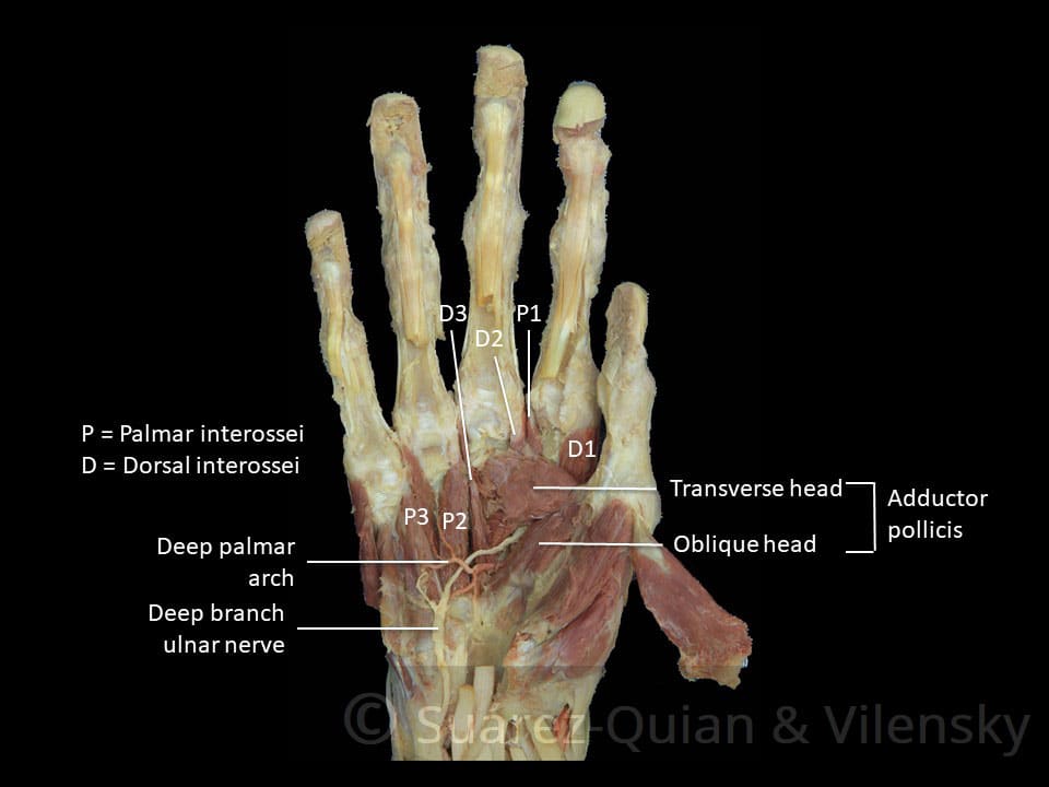 The Muscles of the Hand Thenar Hypothenar TeachMeAnatomy