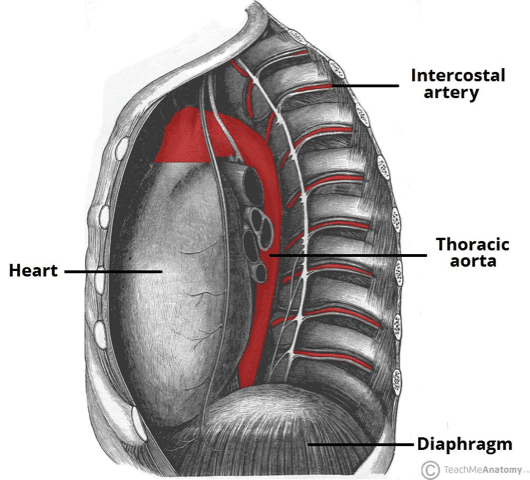 Thoracic Aortic Aneurysms - Clinical Features - Management - Teachmesurgery