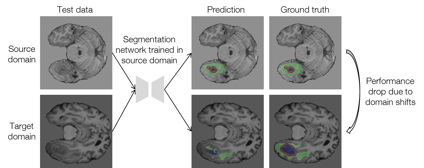 Testtime adaptation for brain tumor segmentation with cross