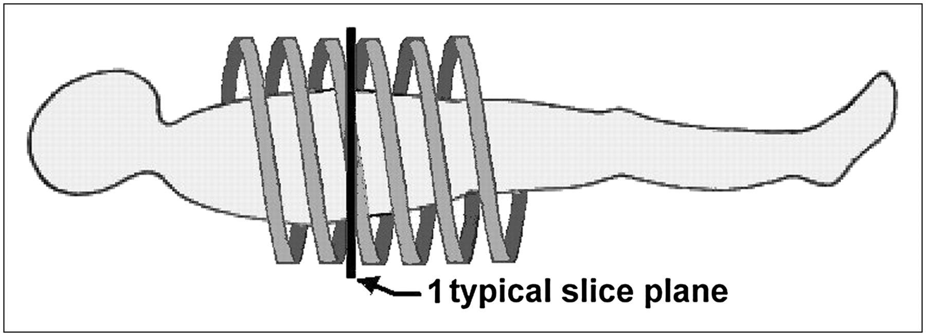 Principles of CT and CT Technology