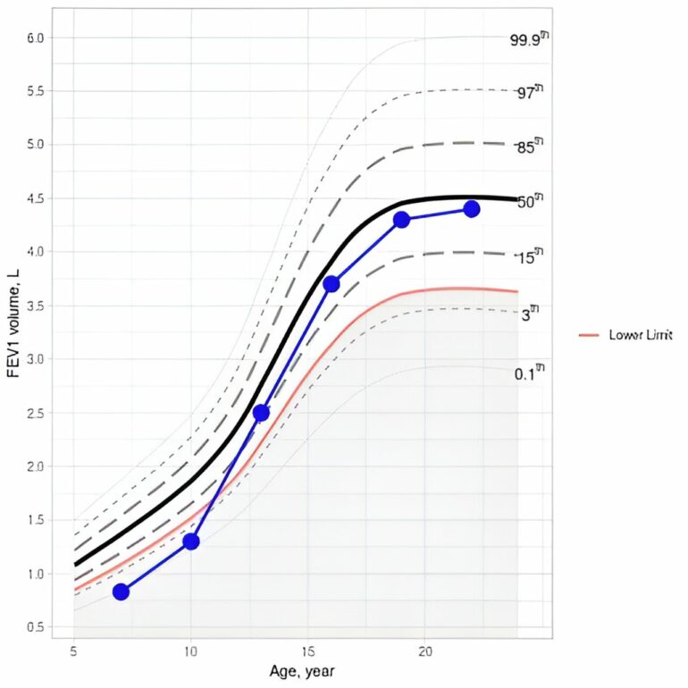 Q&A New digital tool enables monitoring of lung function over time
