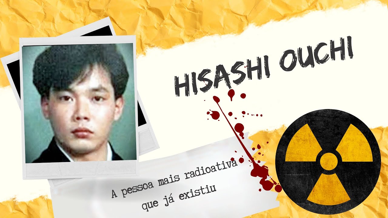 Hisashi Ouchi The Tragic Story Behind His Suffering