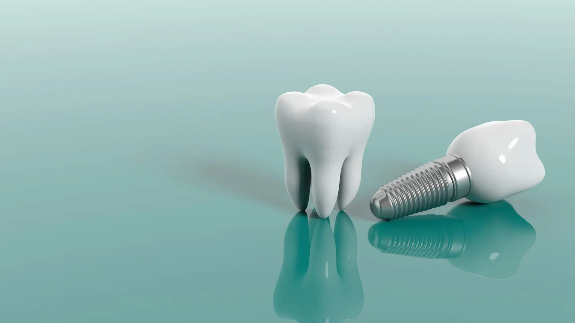 What does a full set of dental implants cost? TechBullion