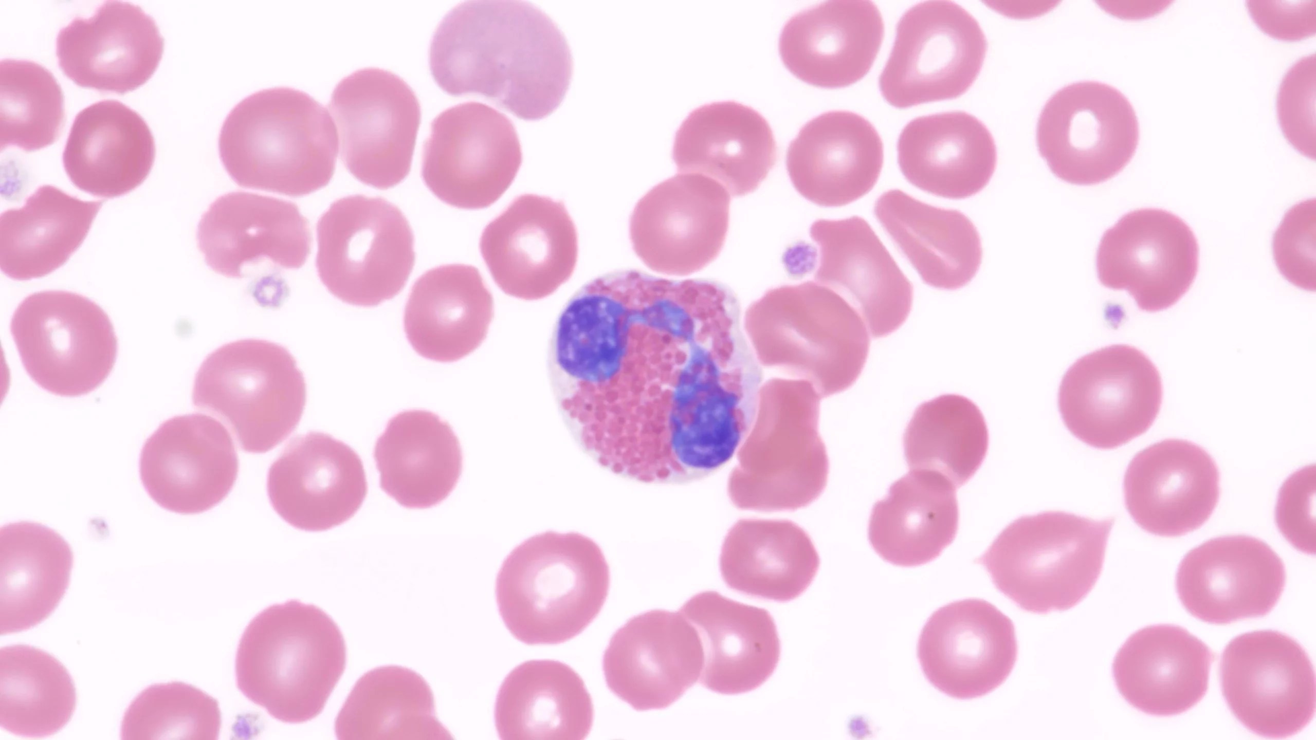 Automated Blood Differential Techcyte