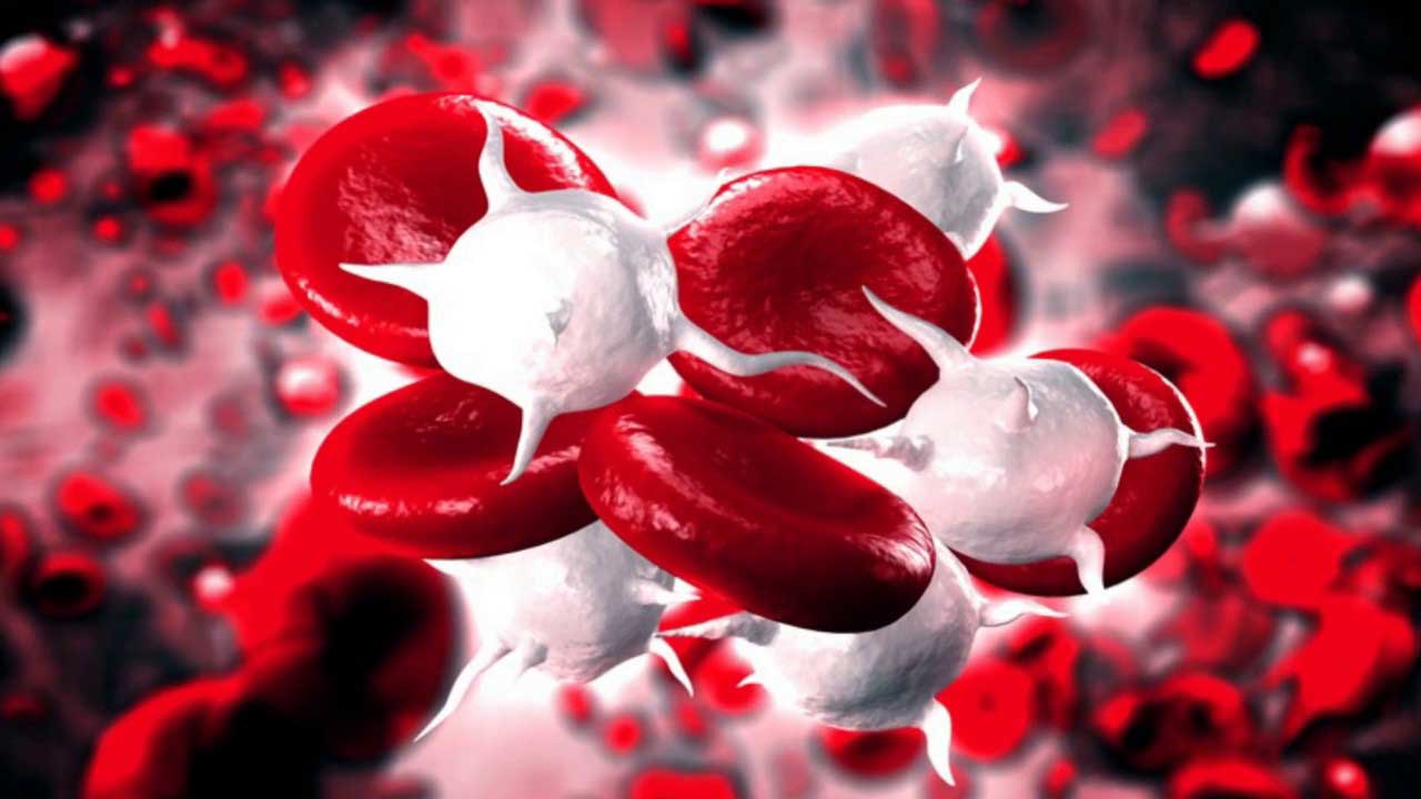 Blood infections need to be treated fast