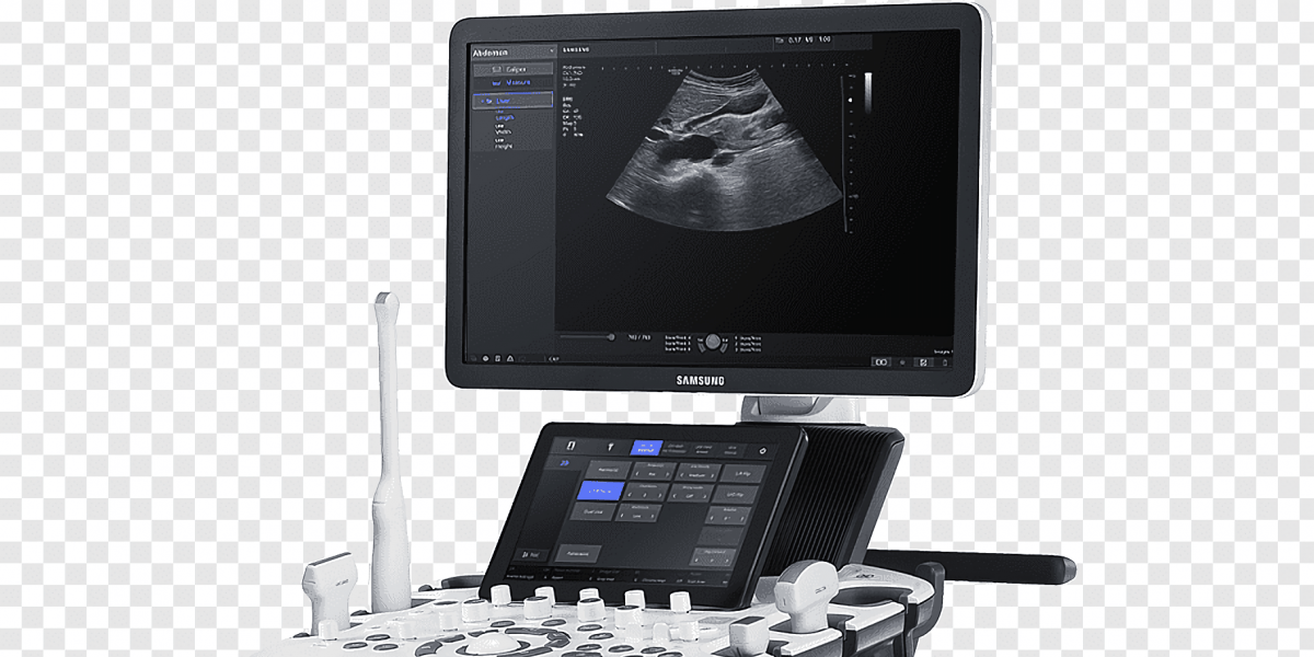 Intel and Samsung detail AIpowered fetal ultrasound tools Techio