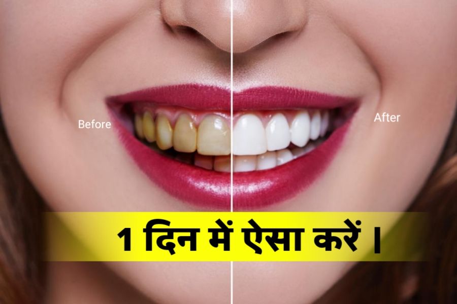 Teeth Cleaning दांतों के पीलेपन और मुंह की बदबू इस तरह हटाए चुटकियों मे
