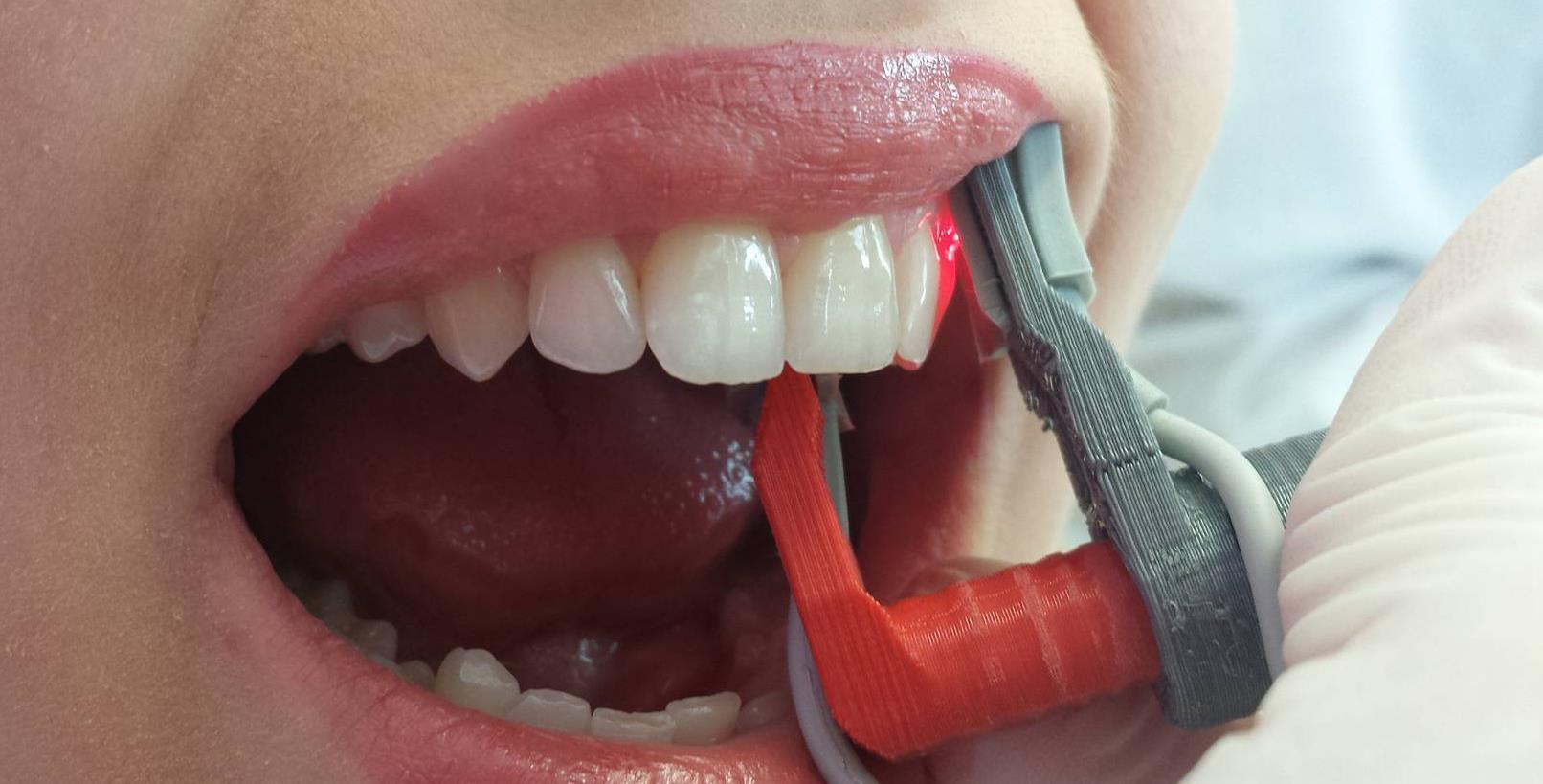 Pulse Oximeter Probe for Dental Use Technorama KTU