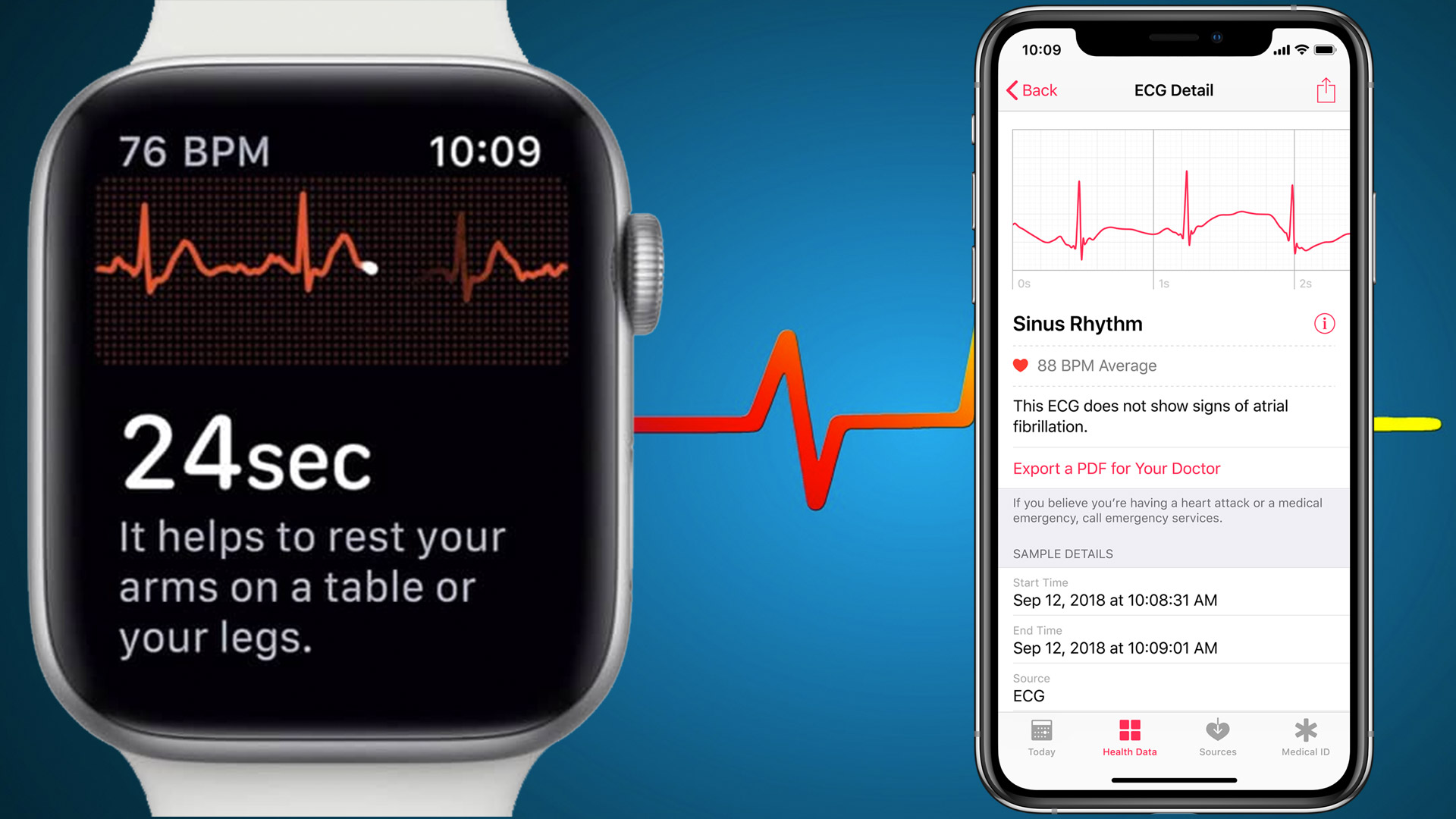 El ECG de apple watch vs los equipos de hospital