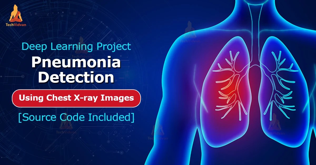 Deep Learning Pneumonia Detection Project using Chest Xray Images