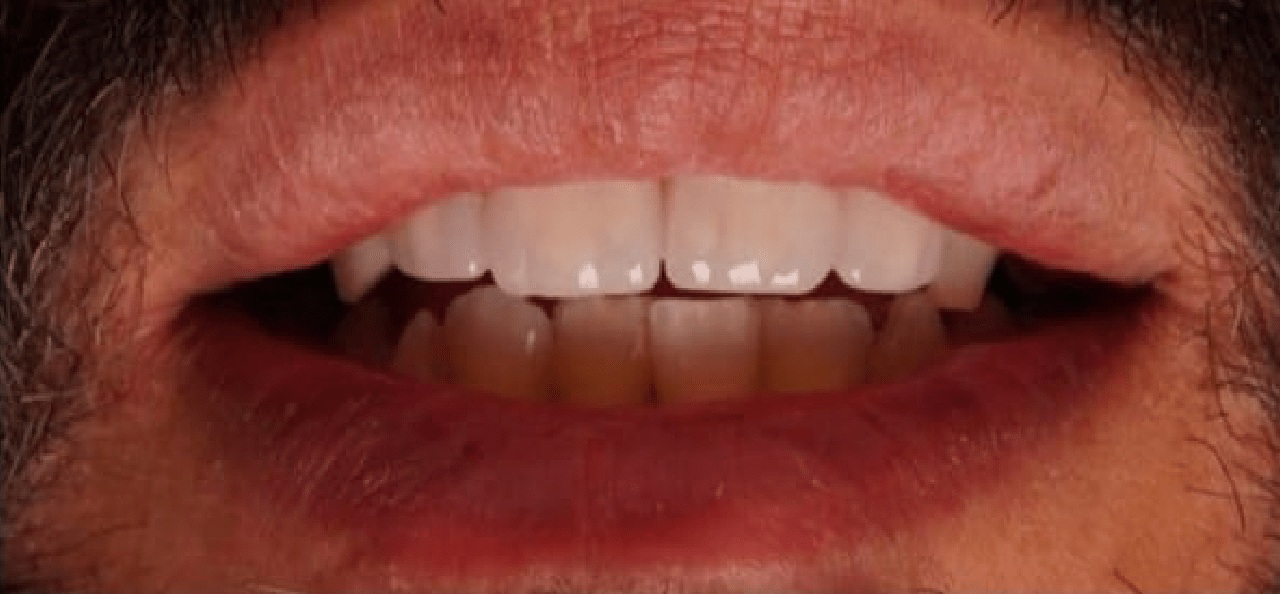 Best Dentists & Dental Clinic Teeth and Smile Dental Clinic Gulberg