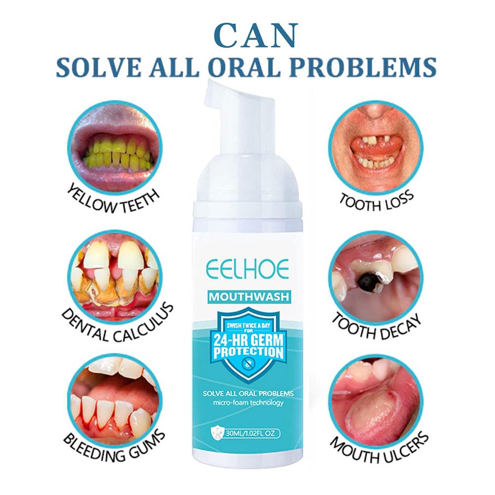 All About the Teethaid Mouthwash Scam Teethandtooth