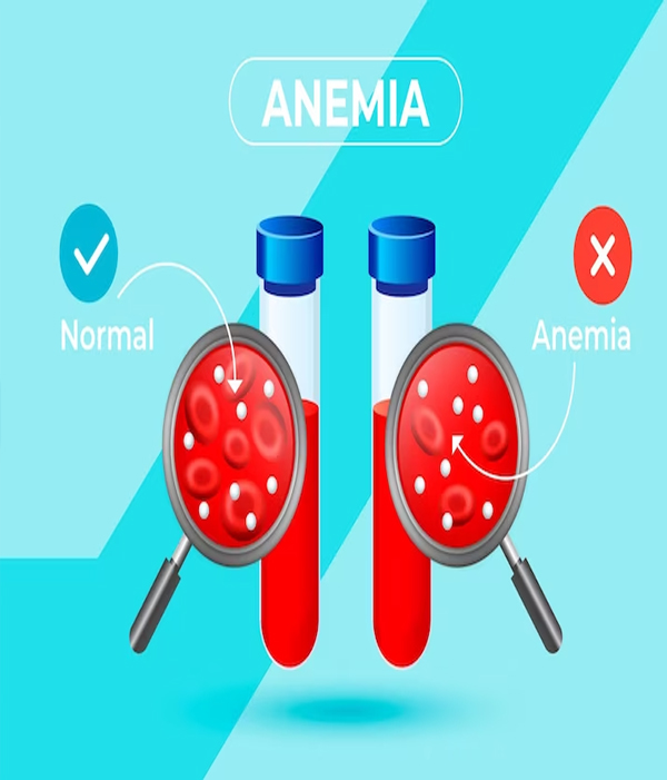 ADVANCED ANEMIA SCREENING Teleradwin