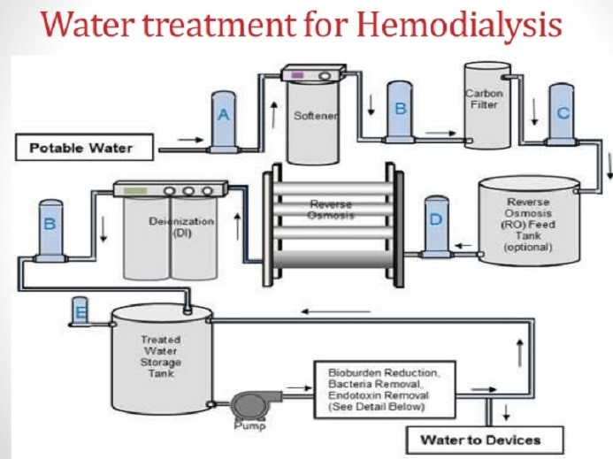 Hemodialysis Water Treatment Systems — Teletype