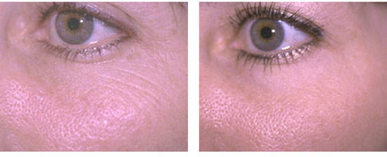 Skin Treatments 2 Temecula Plastic Surgery