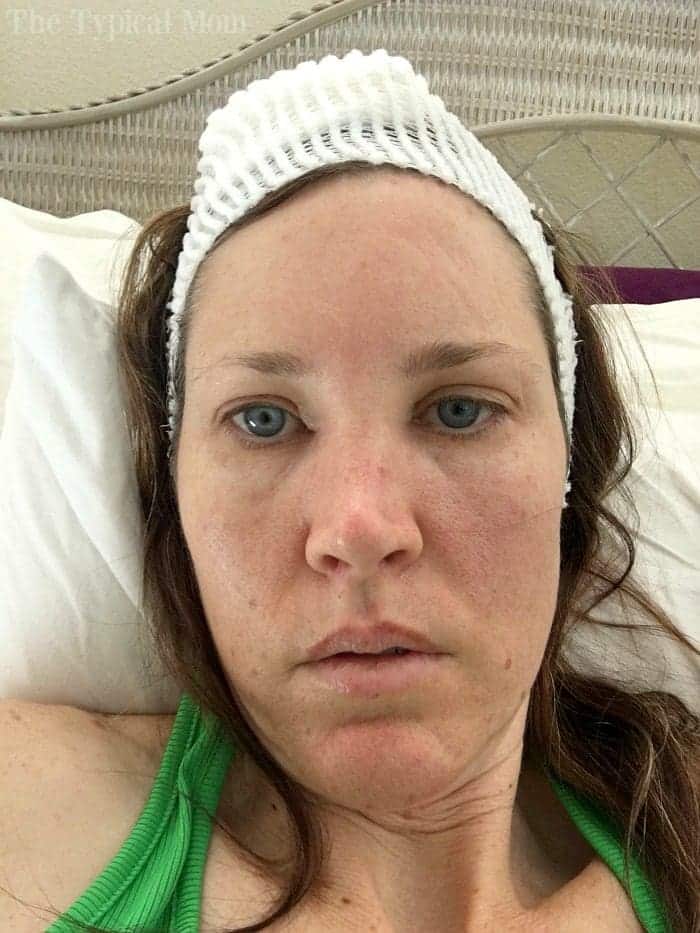 Mohs Surgery Scar Pictures Why You Should Always Trust Your Gut